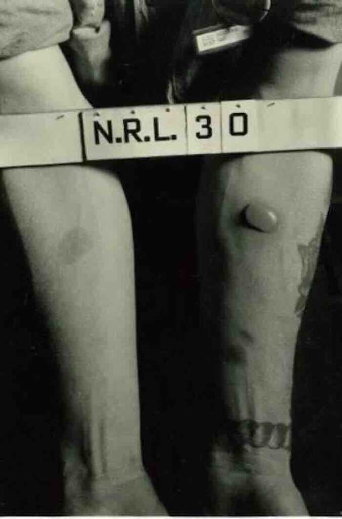 testovi uticaja suptanci na kožu